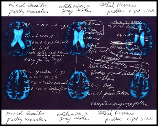 Image MRI